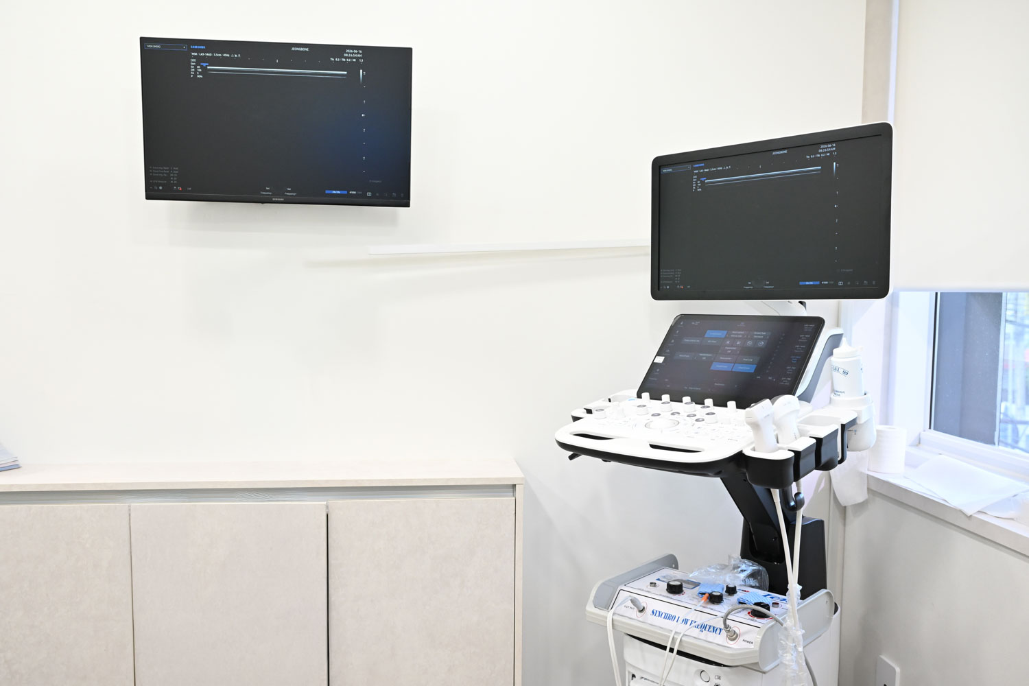 근골격계 초음파 진단기